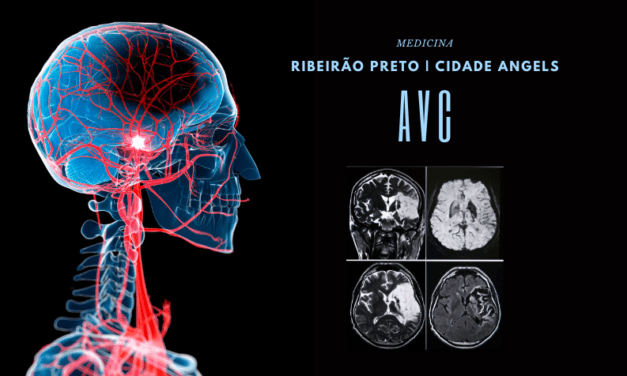 Ribeirão Preto recebe título de primeira cidade do mundo no tratamento de AVC