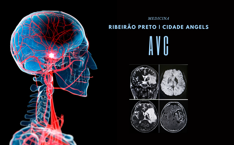 Ribeirão Preto recebe título de primeira cidade do mundo no tratamento de AVC