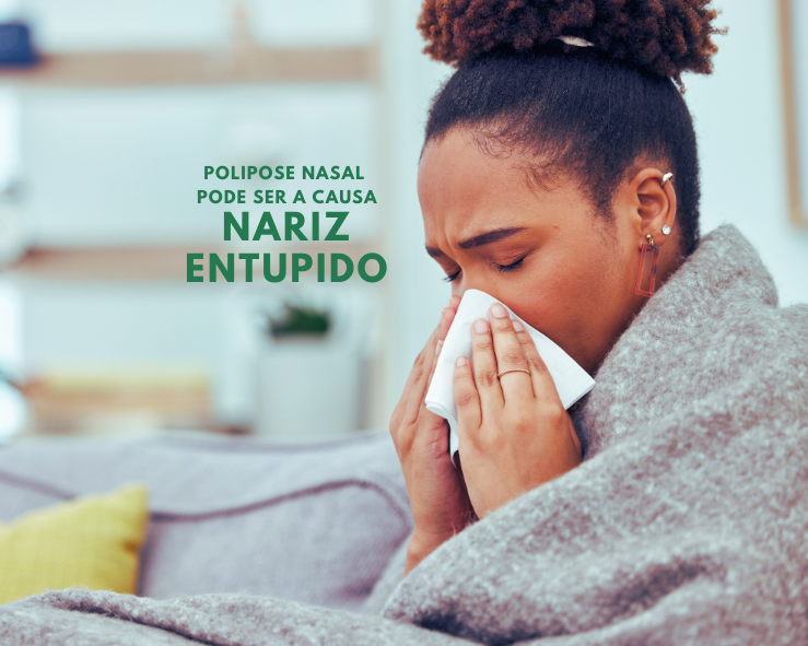 Nariz entupido o tempo todo? Pode ser Polipose Nasal, um problema mais comum (e sério) do que se imagina