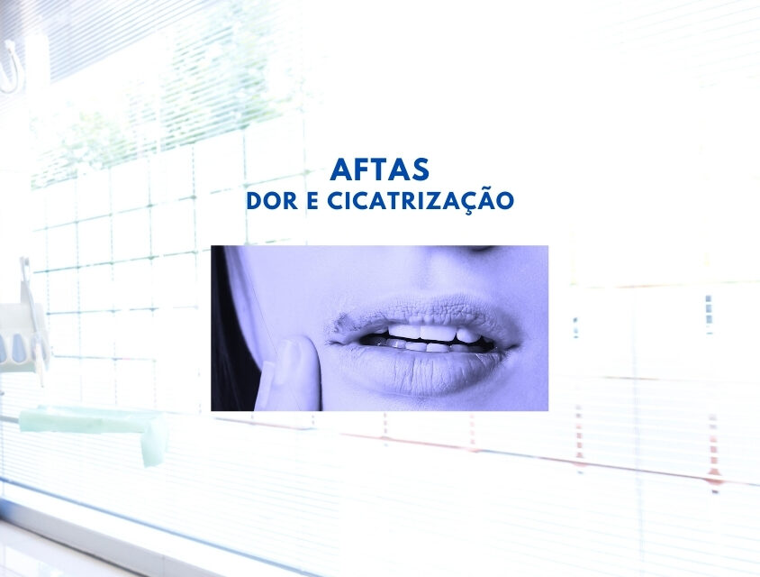 Programa ‘CFO Esclarece’ aponta os principais tratamentos para redução da dor e cicatrização das aftas
