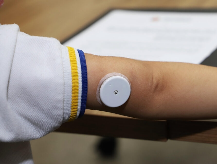 Rede pública de SP distribui aparelhos para medir diabetes tipo 1 em crianças: melhora significativa na qualidade de vida