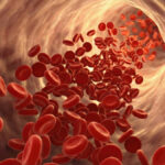 Aneurisma da aorta: entenda o que é a doença silenciosa que pode ser fatal