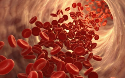 Aneurisma da aorta: entenda o que é a doença silenciosa que pode ser fatal