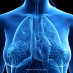 Mamografia pode ajudar a identificar riscos de doenças cardiovasculares em mulheres, alerta especialista