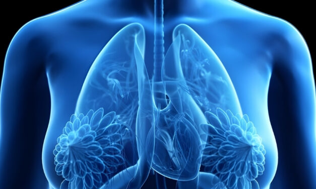 Mamografia pode ajudar a identificar riscos de doenças cardiovasculares em mulheres, alerta especialista