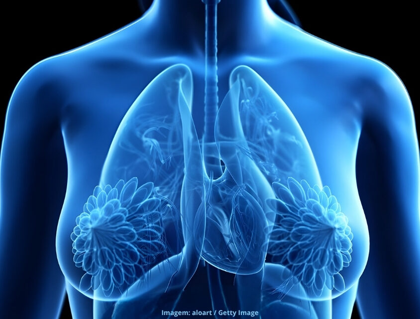 Mamografia pode ajudar a identificar riscos de doenças cardiovasculares em mulheres, alerta especialista