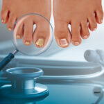 O que suas unhas estão tentando dizer sobre sua saúde?