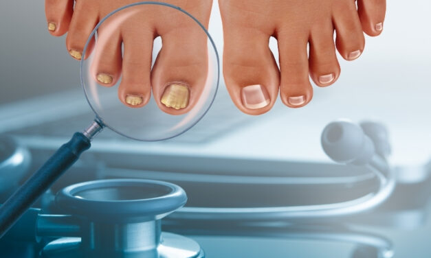 O que suas unhas estão tentando dizer sobre sua saúde?