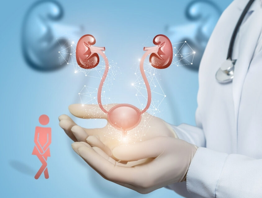 Infecção urinária atinge até 60% das mulheres; saiba como prevenir e identificar os sinais