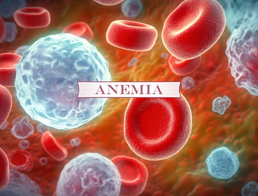 7 mitos e verdades sobre a anemia, doença que afeta 30% da população mundial