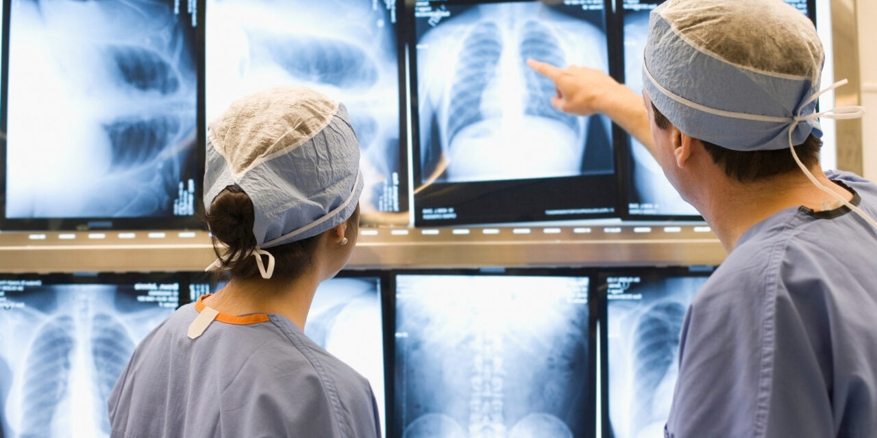 SUS pode ampliar acesso à cirurgia por vídeo para câncer de pulmão