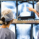 SUS pode ampliar acesso à cirurgia por vídeo para câncer de pulmão