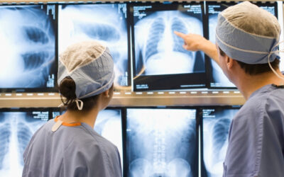 SUS pode ampliar acesso à cirurgia por vídeo para câncer de pulmão