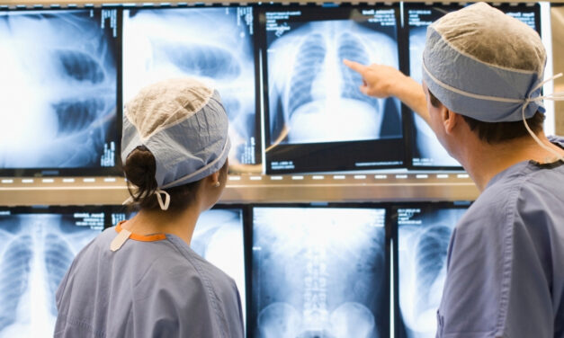 SUS pode ampliar acesso à cirurgia por vídeo para câncer de pulmão